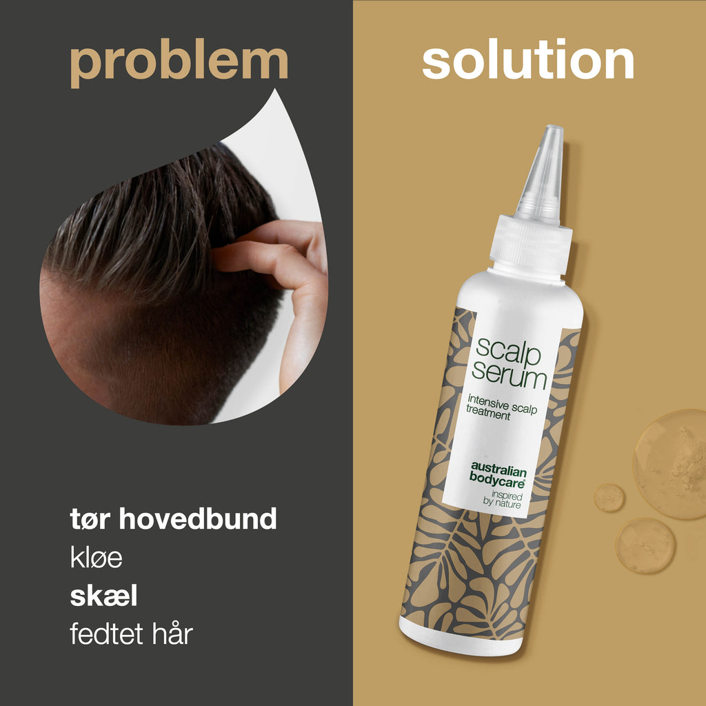 Hovedbundskur mod skæl og tør hovedbund — Serum til kløende hovedbund, fedtet hår og irritation