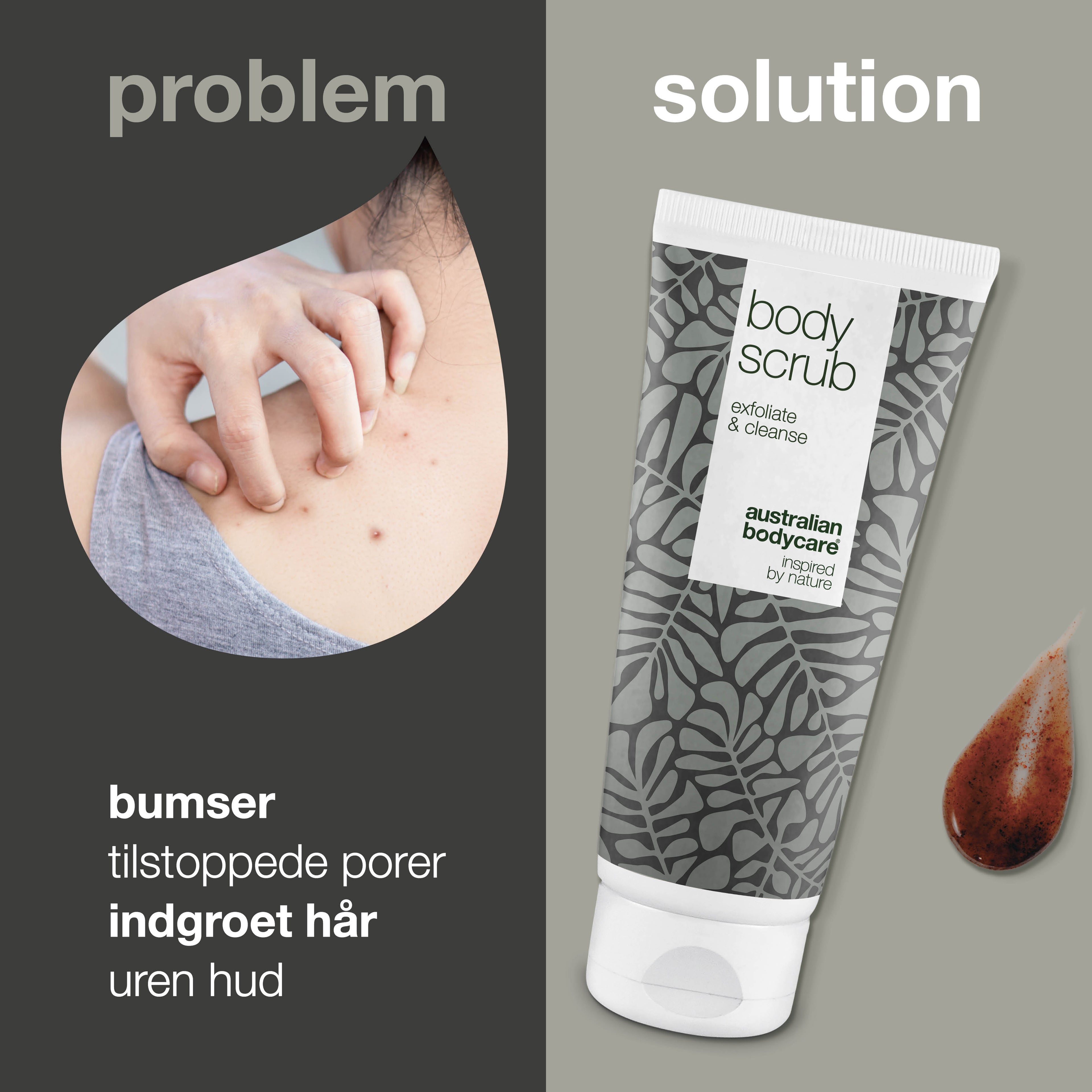 Body Scrub til bumser og uren hud