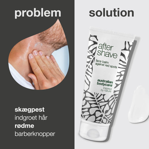 Aftershave lotion til røde barberknopper — Aftershave balm mod skægpest og indgroede hår efter barbering