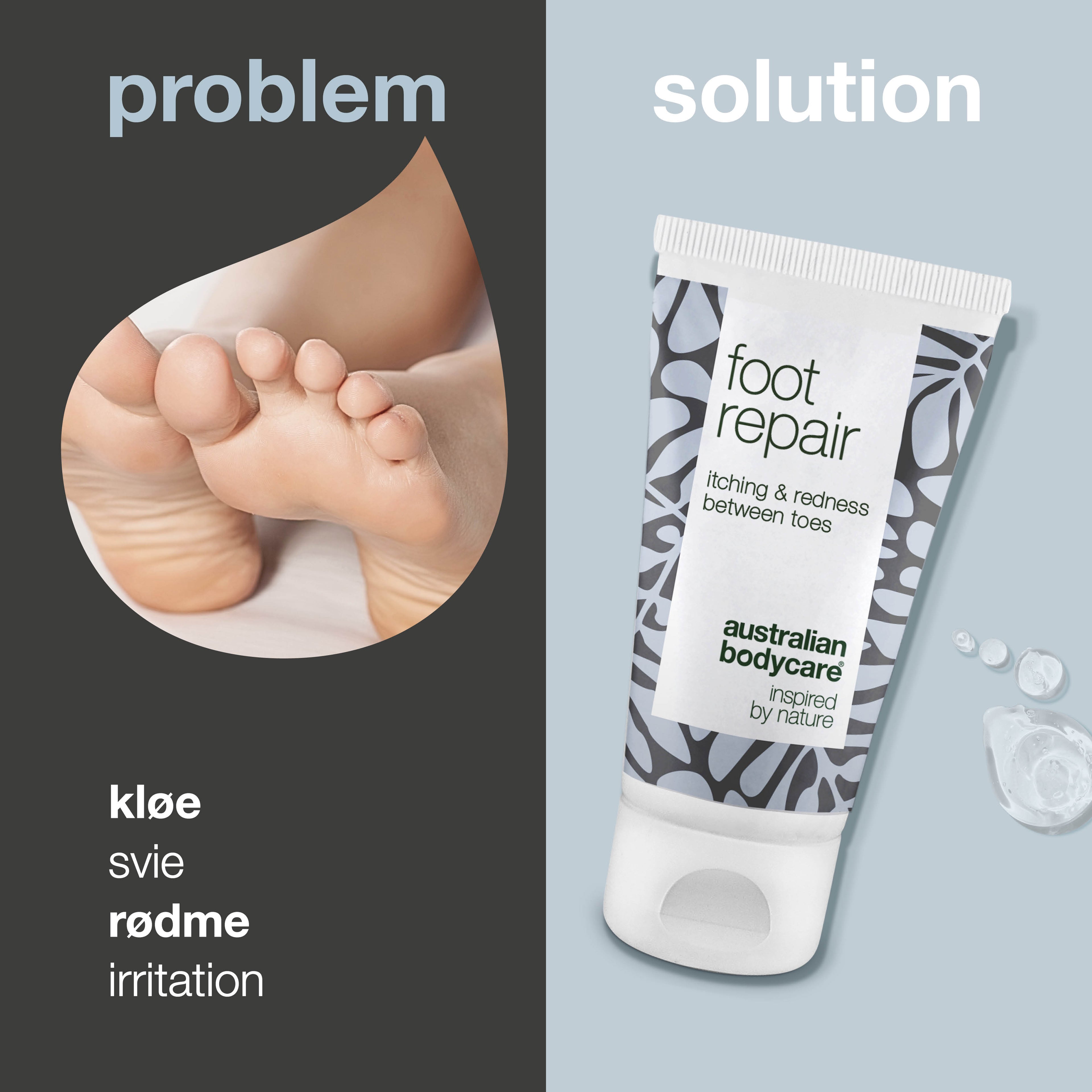 Fodgel med Tea Tree Oil  — Lindrende gel mod kløe, svie og rødme mellem tæerne.