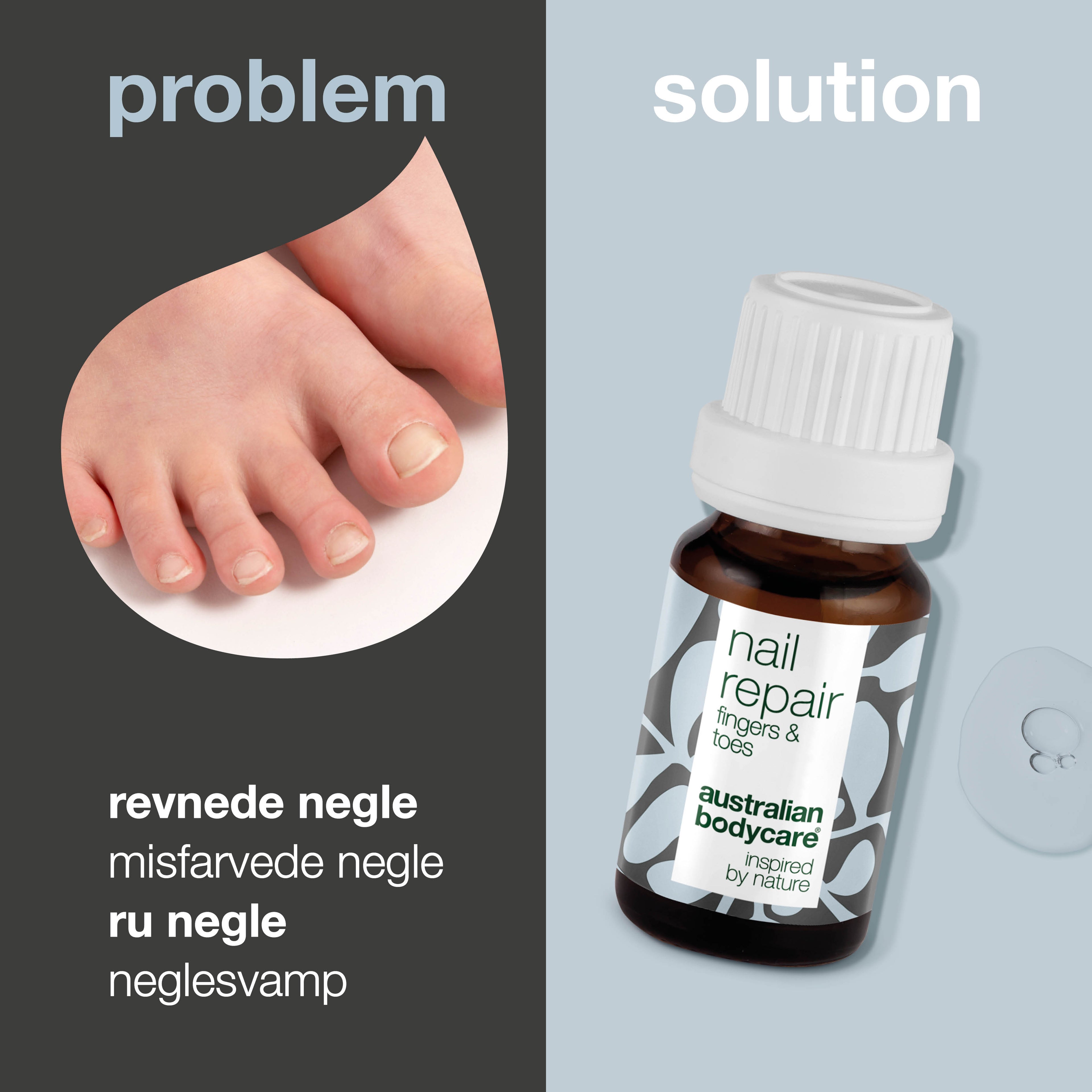 Negleolie til Neglepleje — Neglepleje til misfarvede, revnede og ru negle