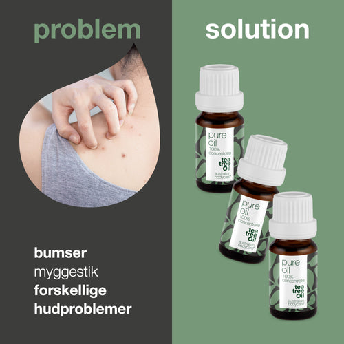 3 stk. XL 30 ml Tea Tree Oil til hudproblemer