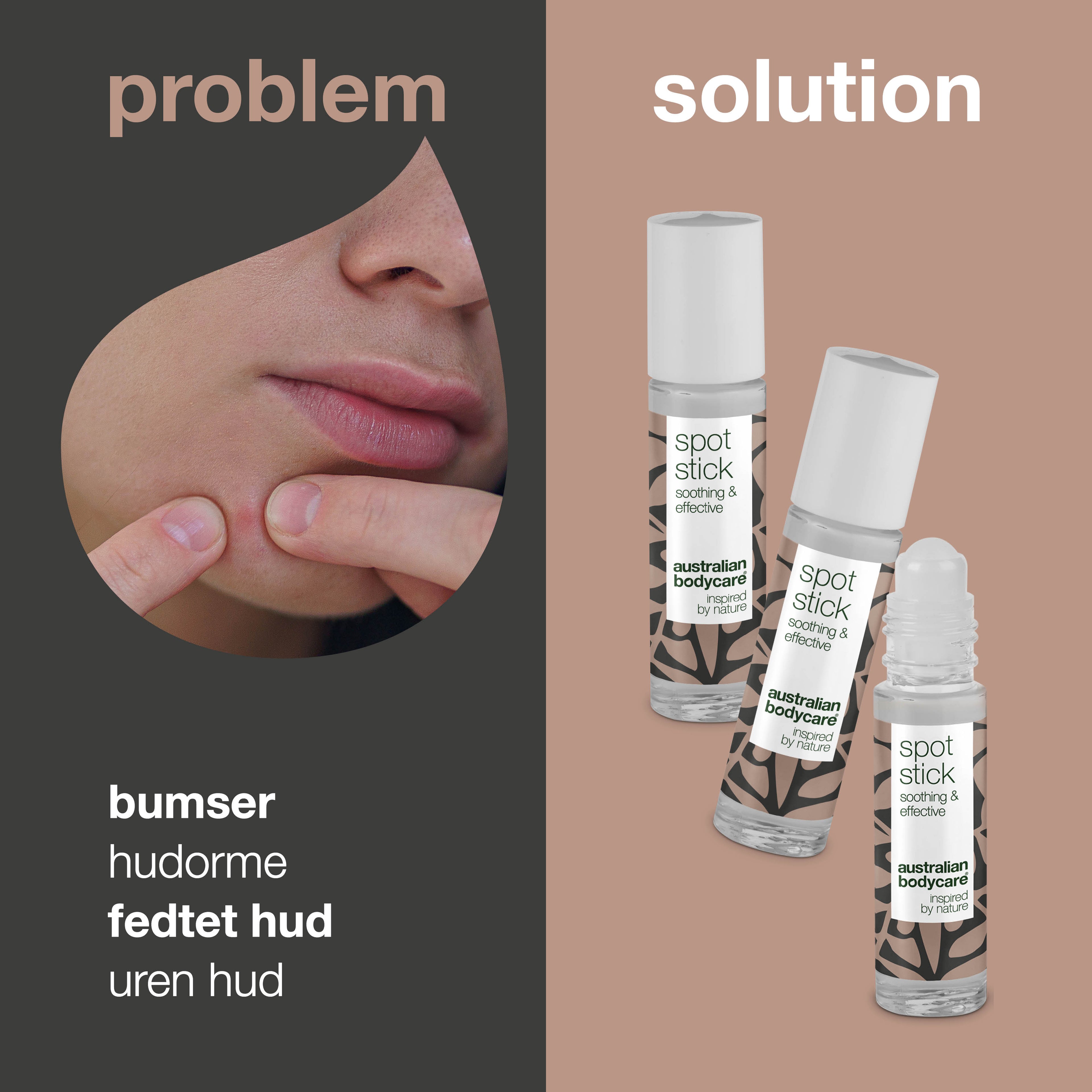 3 stk. Spot Stick til bumser og uren hud — Effektiv mod bumser, uren hud og hudorme