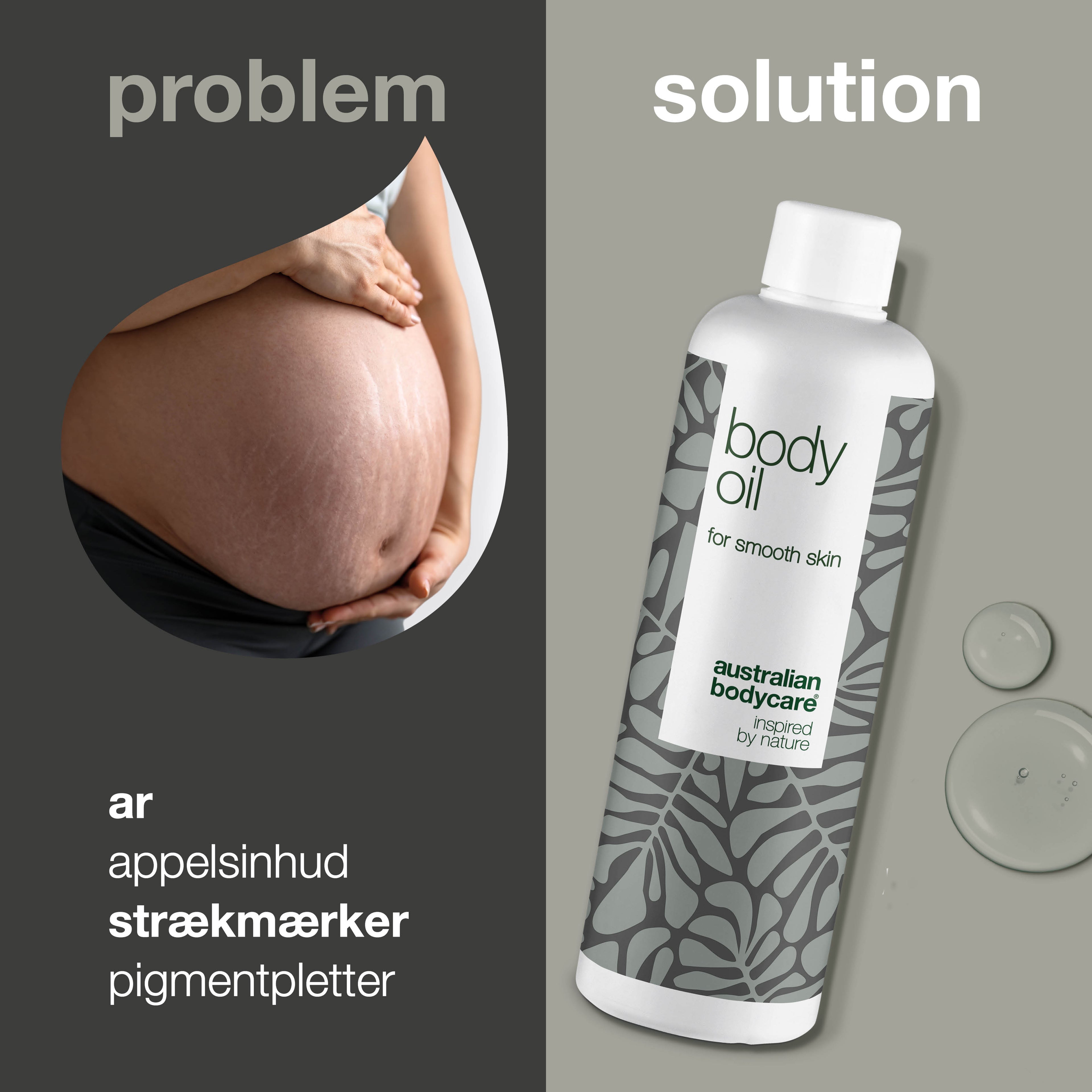 Body Oil – Reducerer strækmærker, ar og pigmentpletter — Body Oil reducerer strækmærker, ar og pigmentpletter. Med mandelolie, squalane og vitamin E efterlades huden blød, smidig og velplejet.