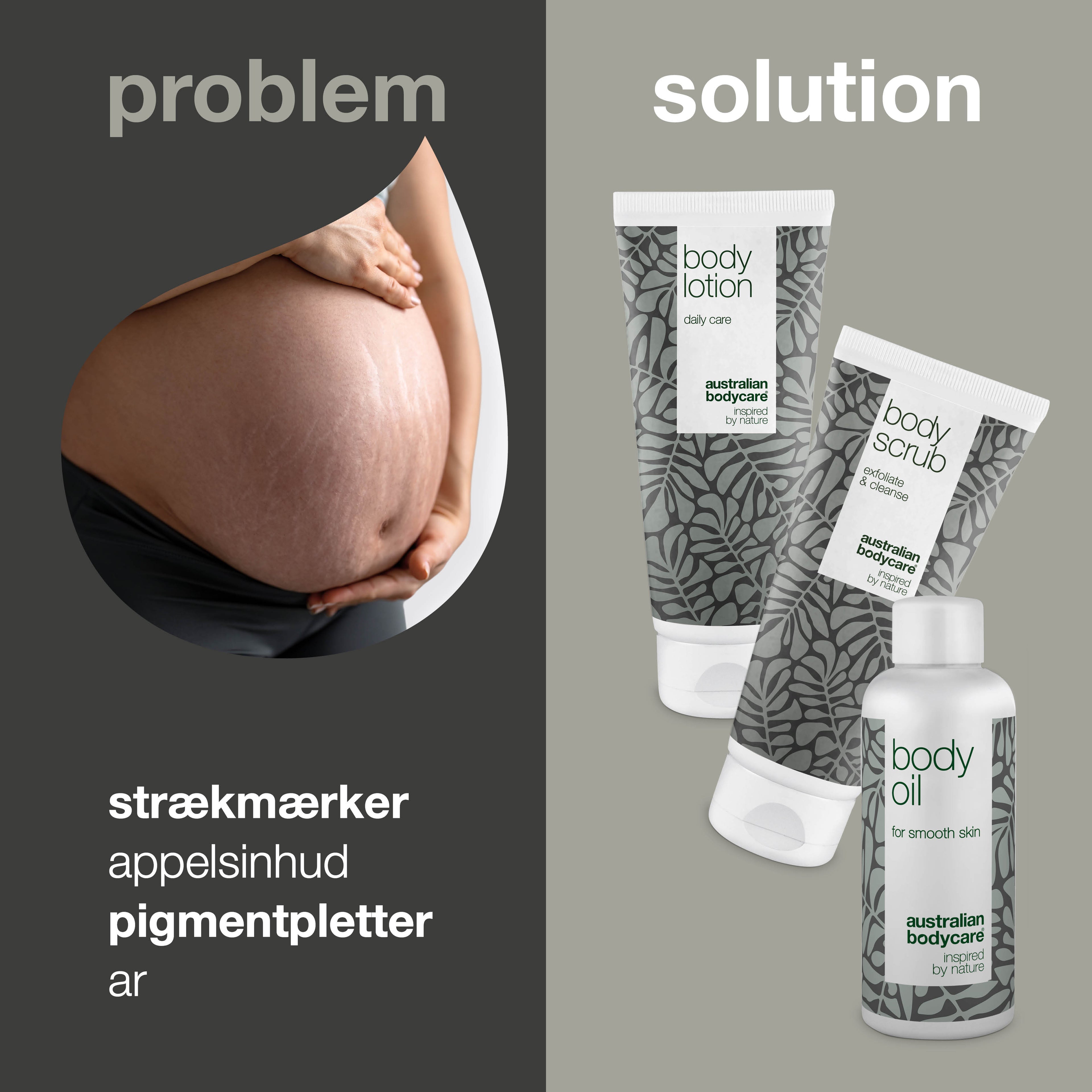 3-pak til strækmærker — 3 produkter til at reducere synligheden af strækmærker og ar