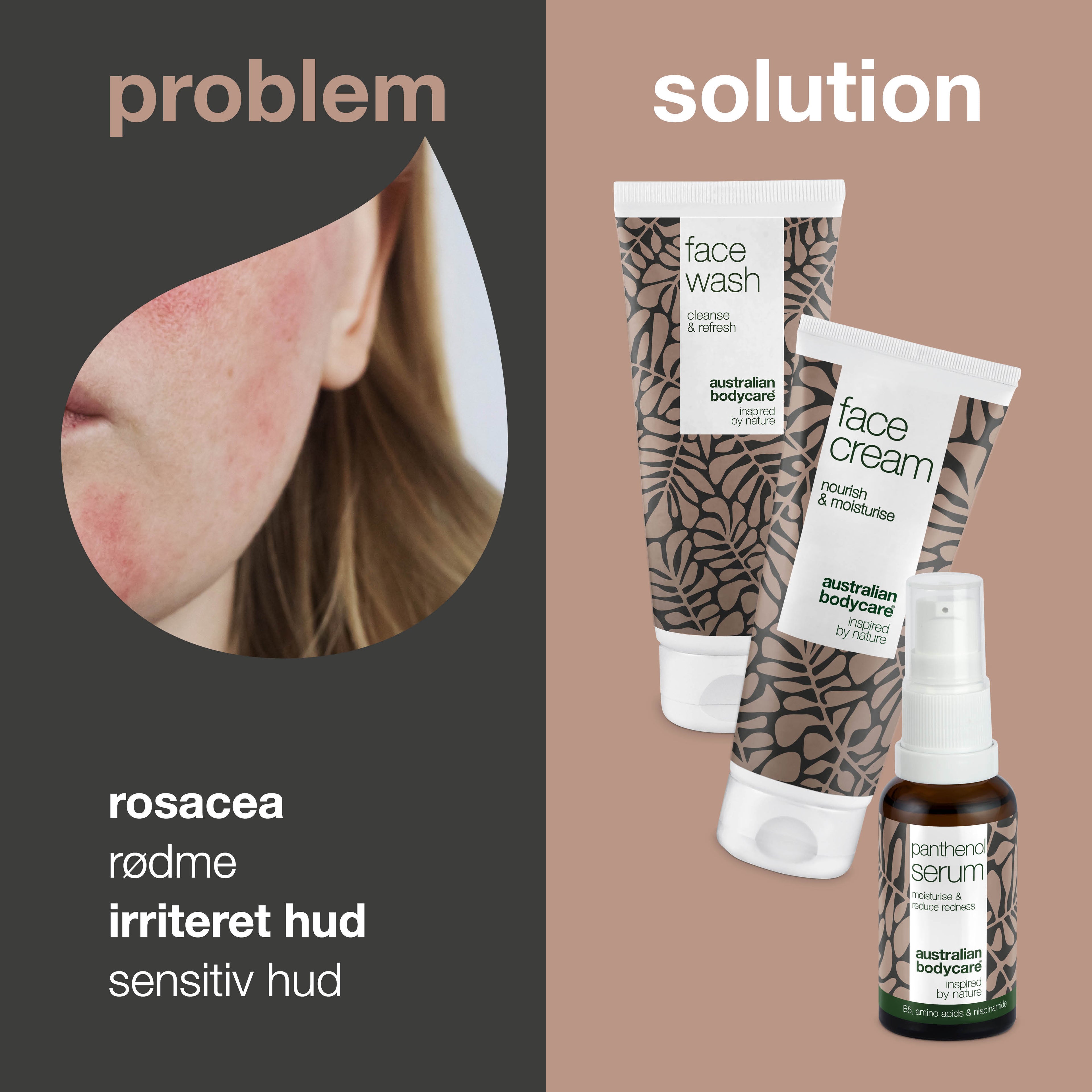 Sæt til pleje af rosacea, rødme & sensitiv hud — 3 beroligende produkter kan bruges ved rosacea: rens, B5 Serum & creme