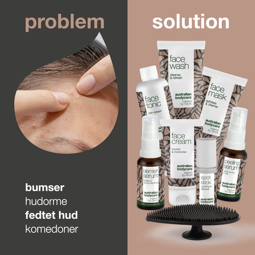 8 ansigtsprodukter til bumser og uren hud — Daglig pleje ved fedtet hud og tilstoppede porer