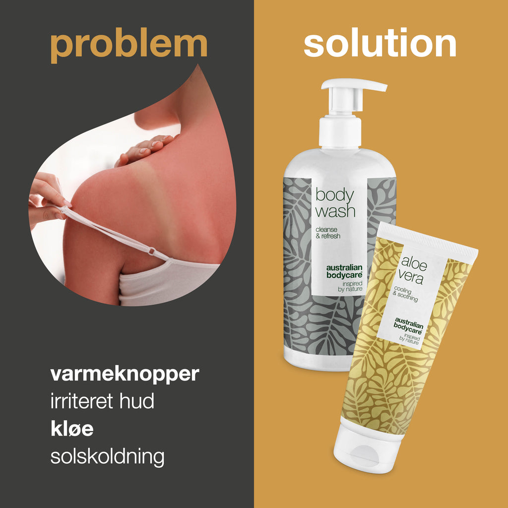 2-pak til pleje ved varmeknopper — Produkter til pleje af varmeknopper, svie og irriteret hud