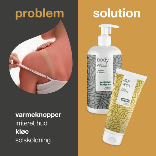 2-pak til pleje ved varmeknopper — Produkter til pleje af varmeknopper, svie og irriteret hud