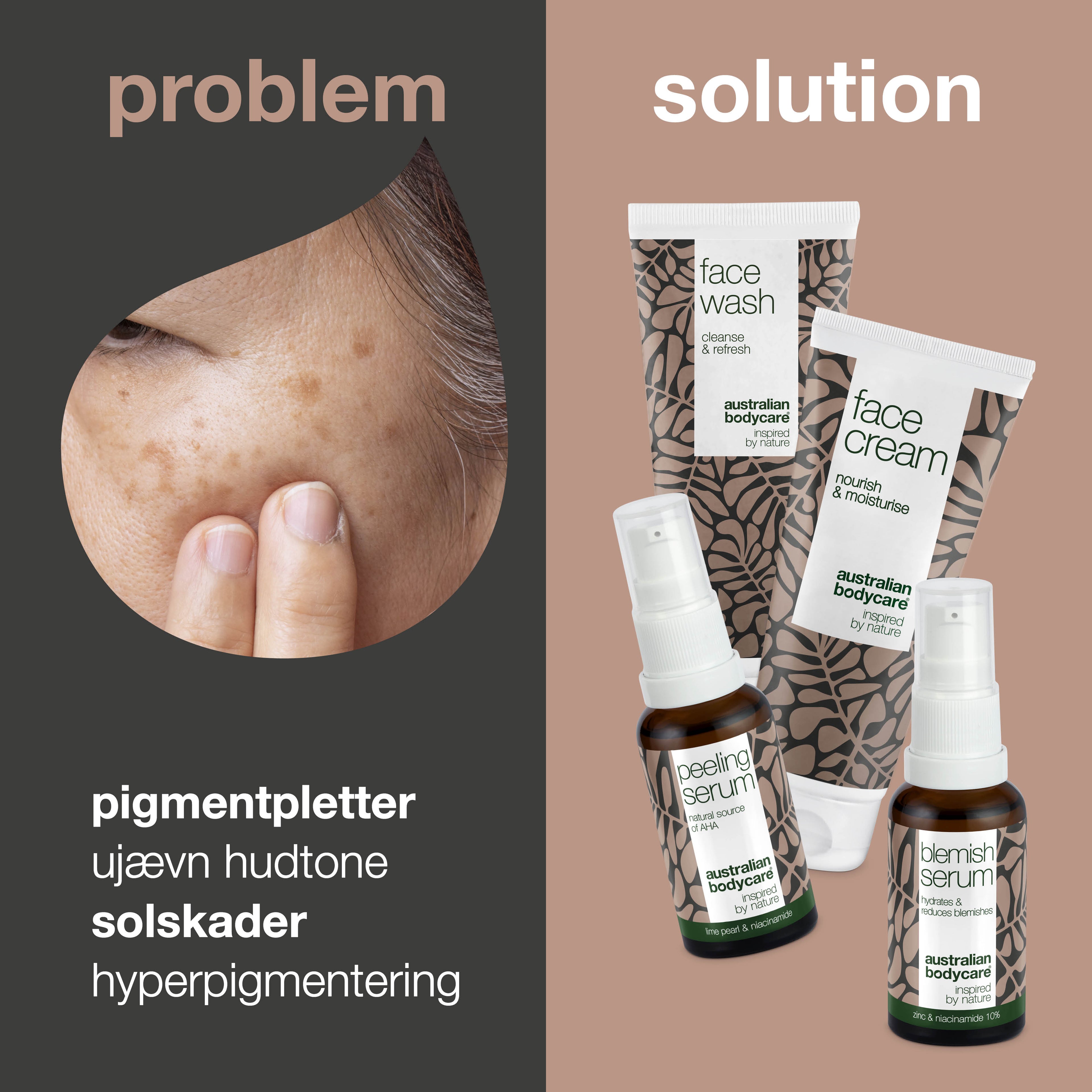 4-pak til pigmentpletter i ansigtet — Reducerer pigmentproblemer i ansigtet