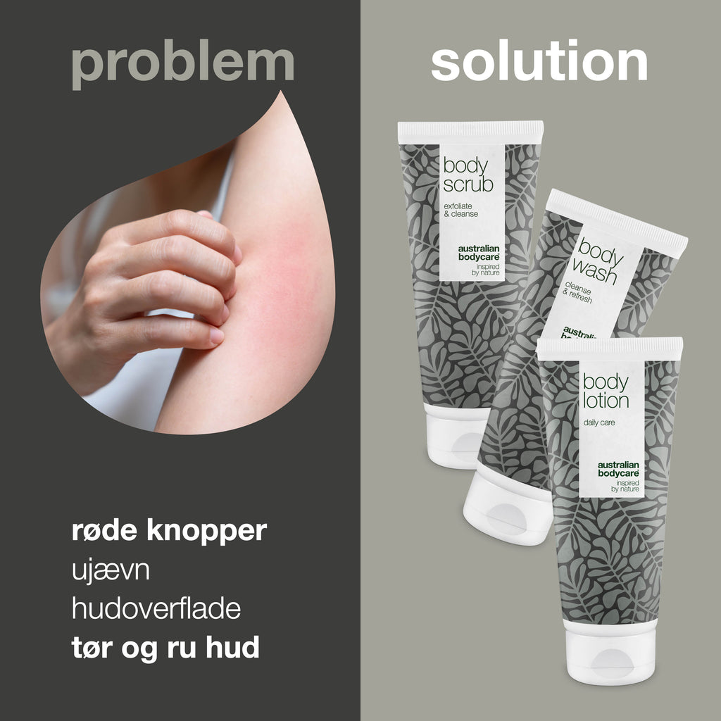 3-pak til keratosis pilaris — minimerer små røde knopper på kroppen fra keratosis pilaris