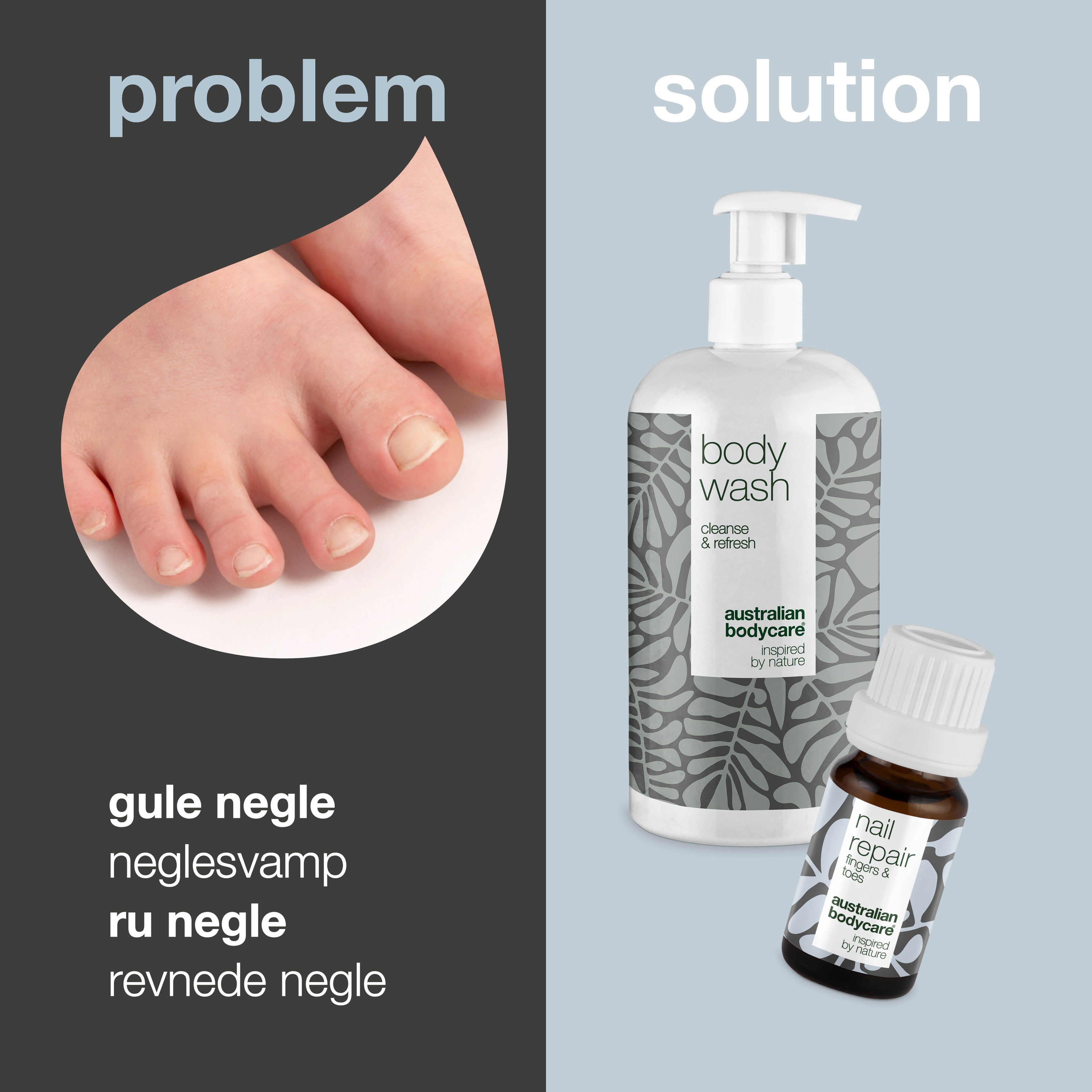 Neglepleje til gule negle — 2 produkter til daglig pleje ved neglesvamp