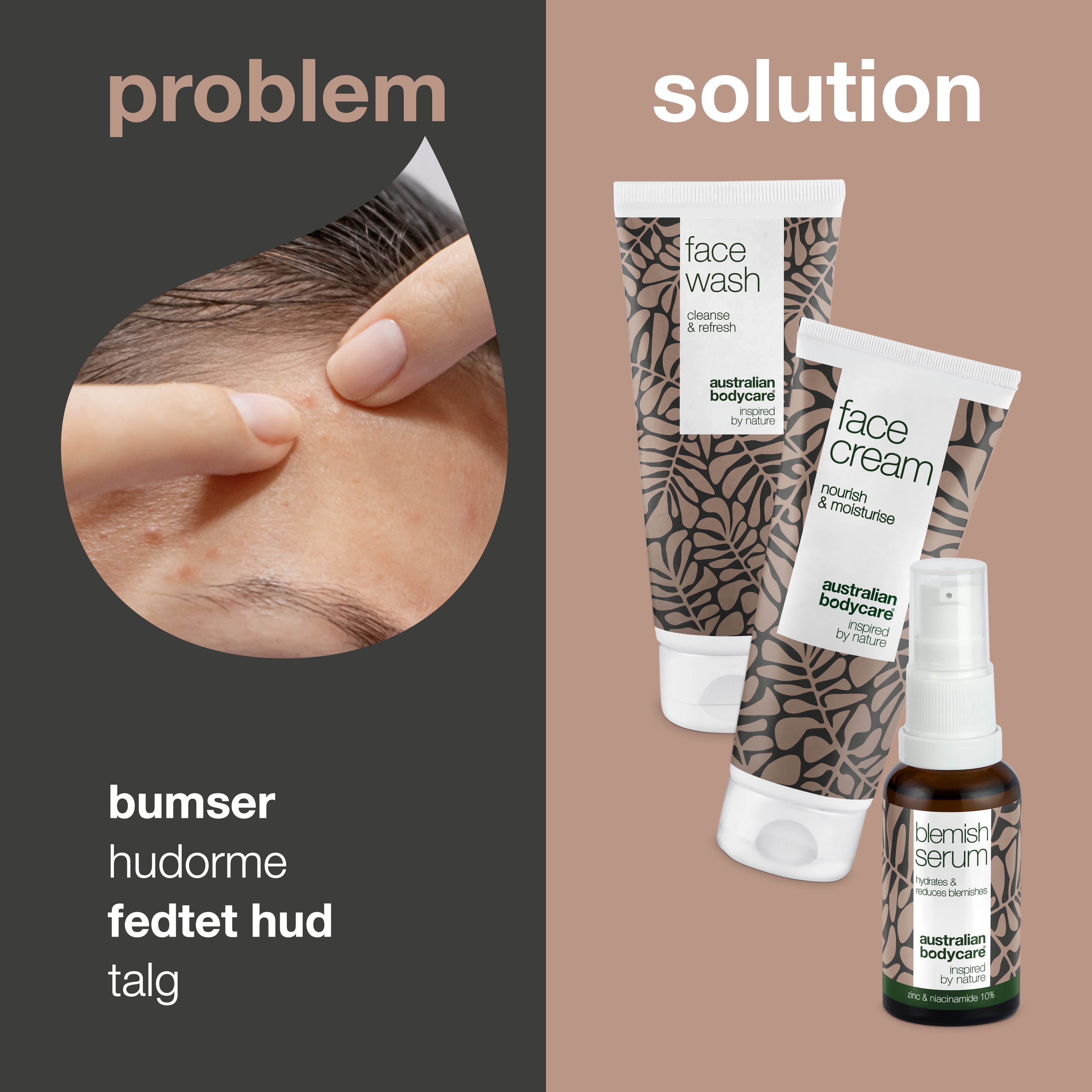 Sæt til uren hud og bumser — 3 produkter til daglig pleje ved akne og fedtet hud