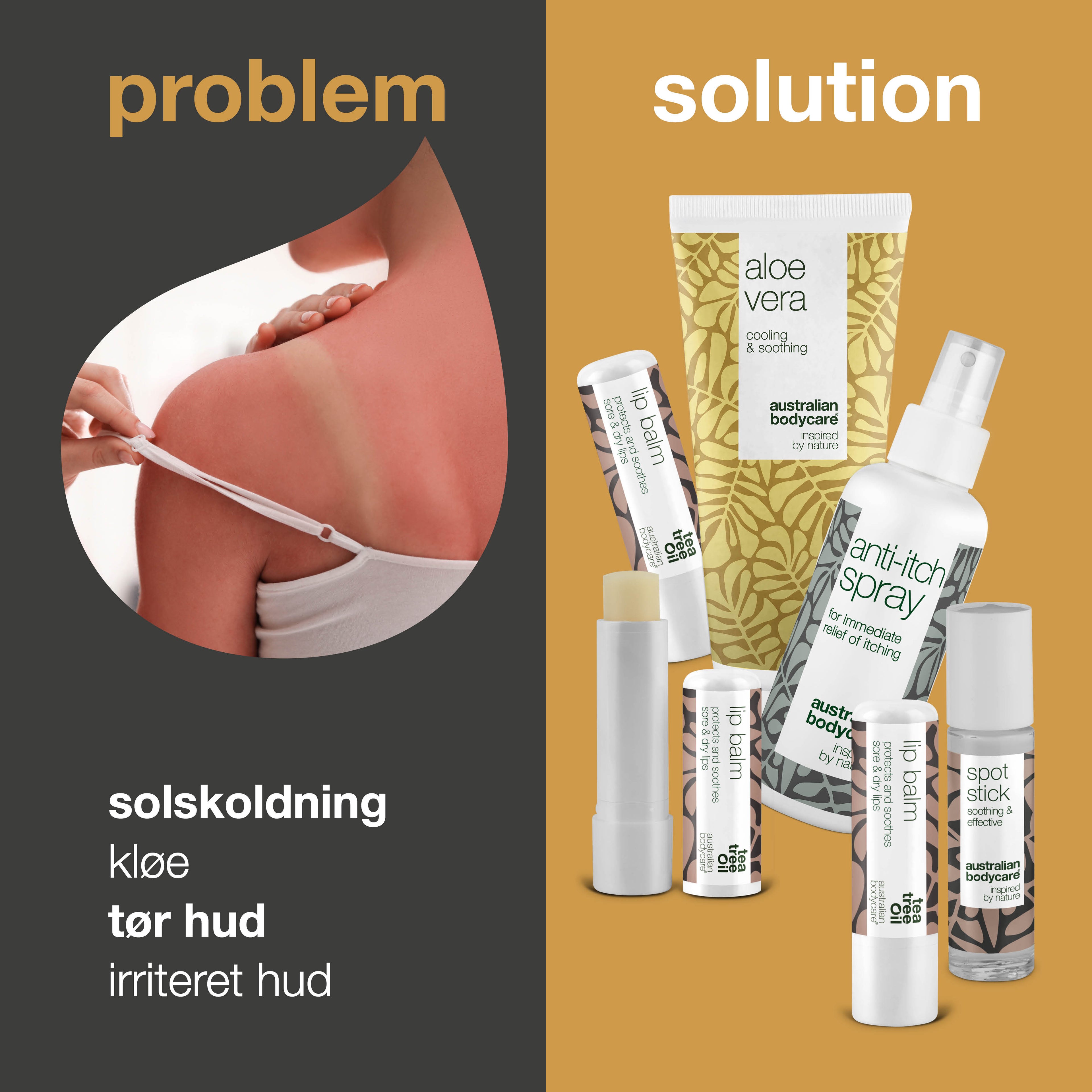 Sommerpakke — Produkter til pleje ved solskoldning eller insektbid