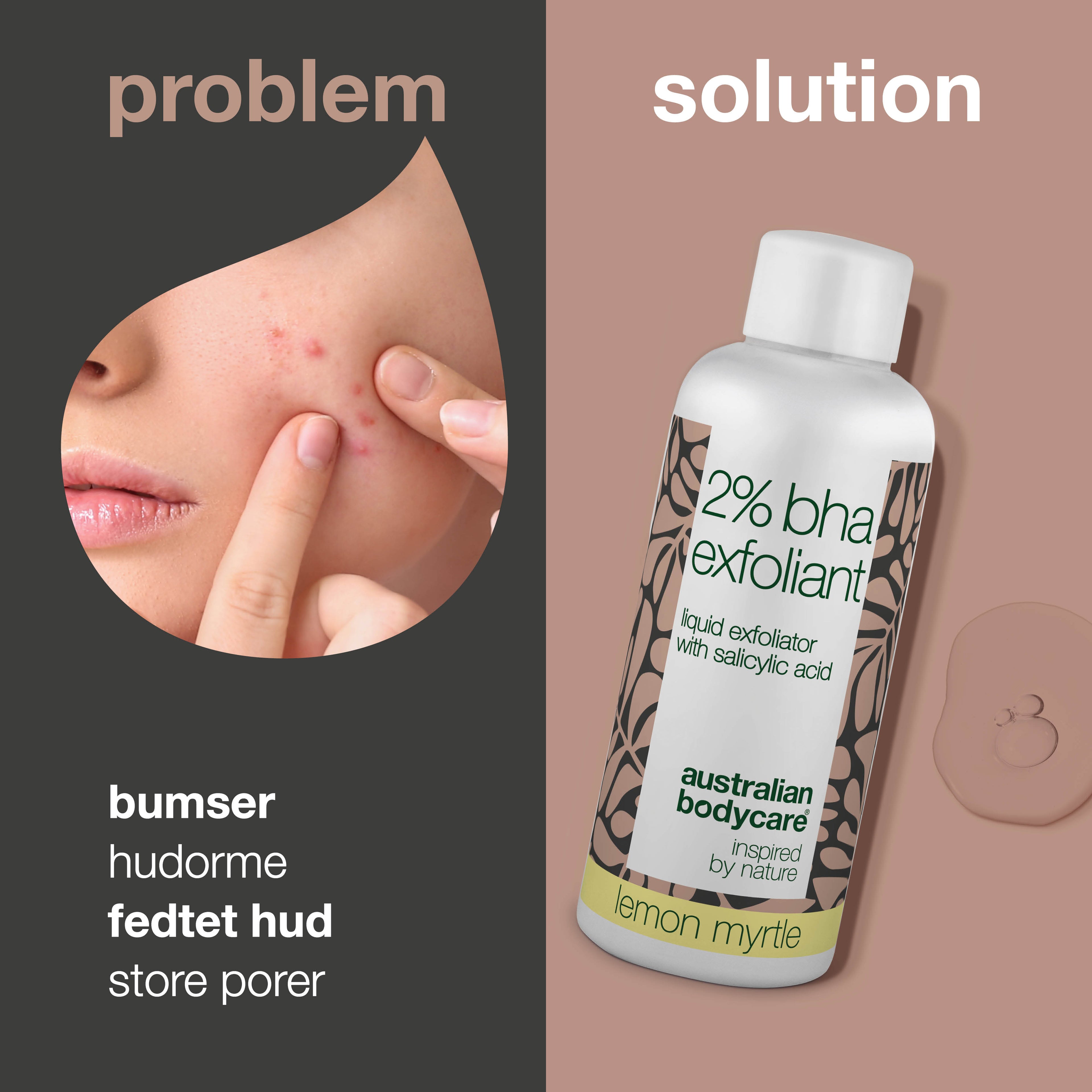 T-zone Peeling 2% BHA – Mod hudorme, bumser & fedtet hud — T-zone Peeling med 2% BHA salicylsyre reducerer bumser, hudorme og overskydende olie. Få en renere hud med færre urenheder.