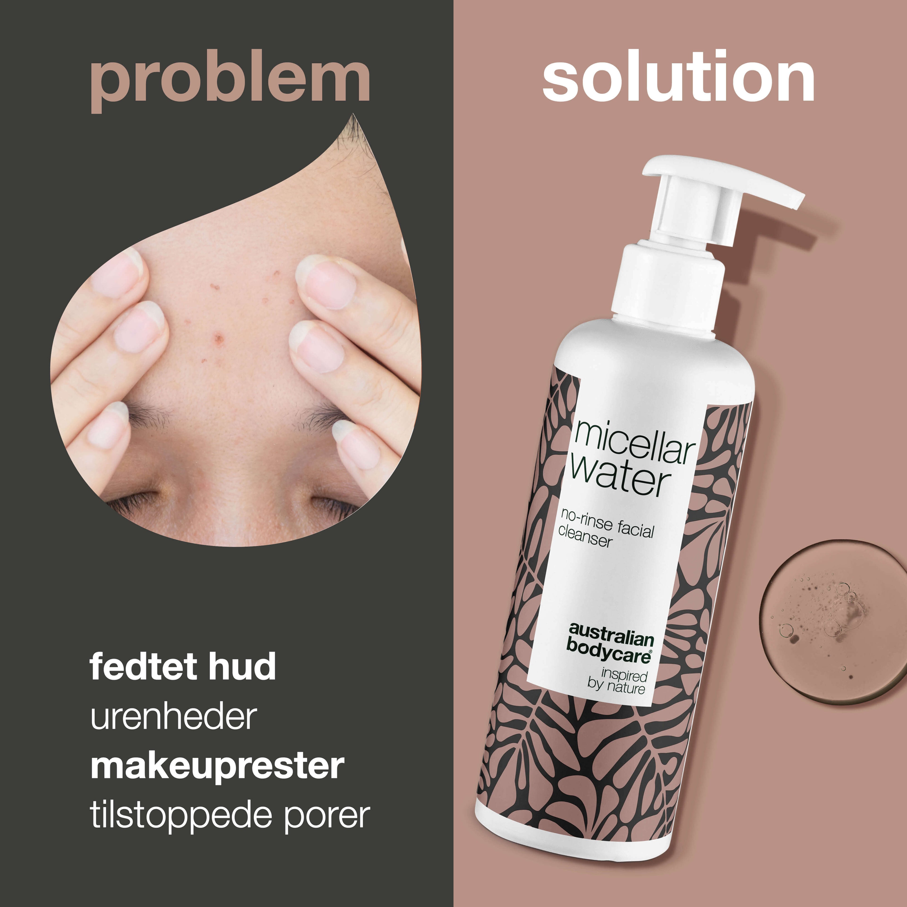 Micellar Water – Effektiv rens til uren og fedtet hud — Micellar Water fjerner makeup, snavs og overskydende olie. Perfekt til uren hud og daglig ansigtsrens.