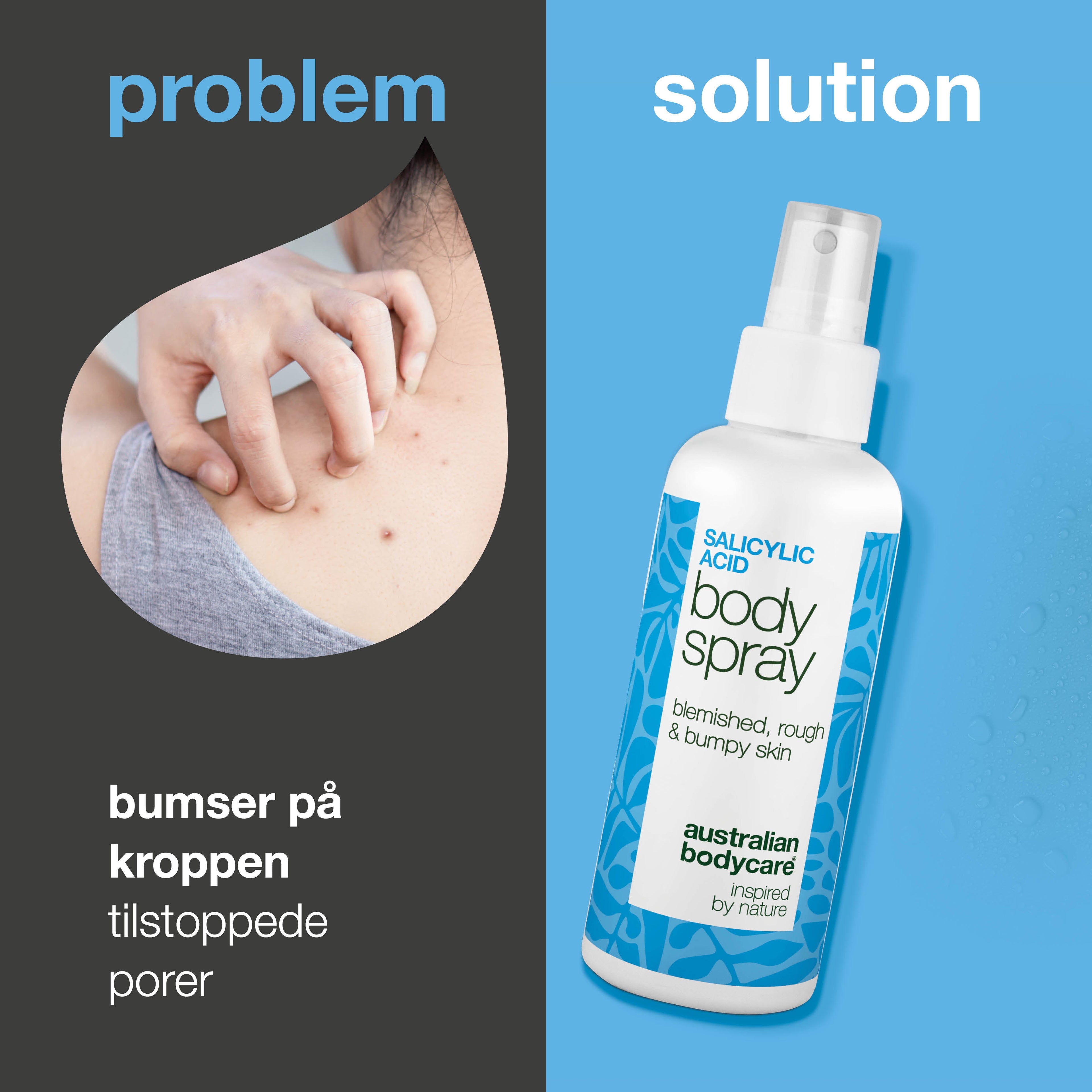 Salicylsyre spray mod bumser og uren hud på kroppen — Salicylsyre spray mod bumser og uren hud. Indeholder salicylsyre og glycolic acid, der renser porer og giver smuk hud.