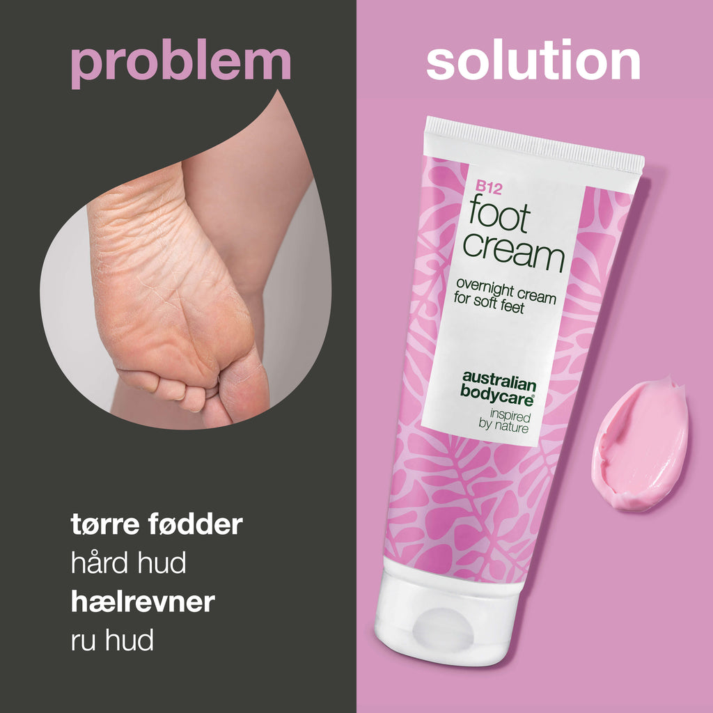 Fodcreme med B12 vitamin – blødgør hård hud og fugter — Fodcreme med B12 vitamin og 10% urea til tørre fødder. Fugter og blødgør huden. Perfekt som natcreme eller efter et fodbad.