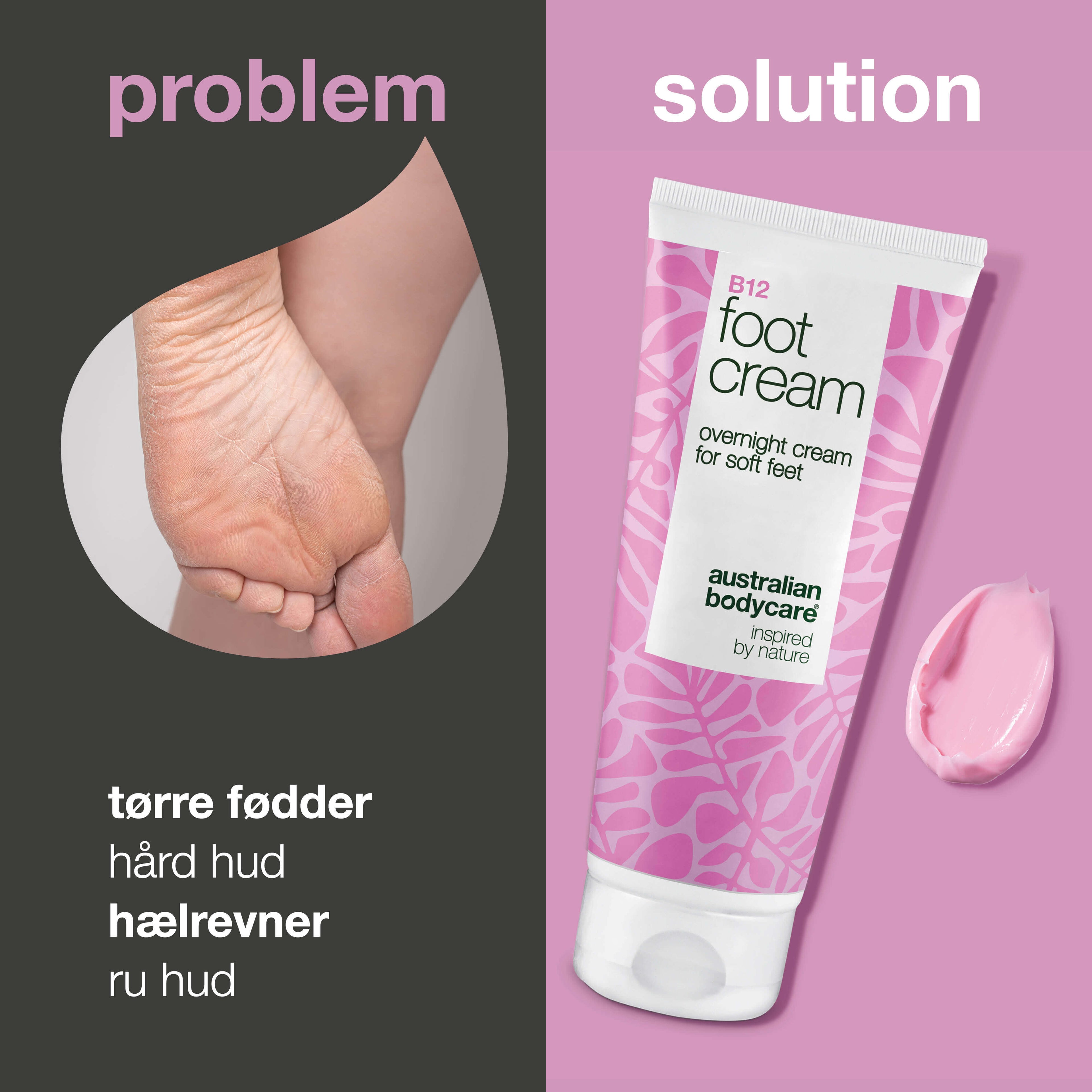 Fodcreme med B12 vitamin – blødgør hård hud og fugter — Fodcreme med B12 vitamin og 10% urea til tørre fødder. Fugter og blødgør huden. Perfekt som natcreme eller efter et fodbad.