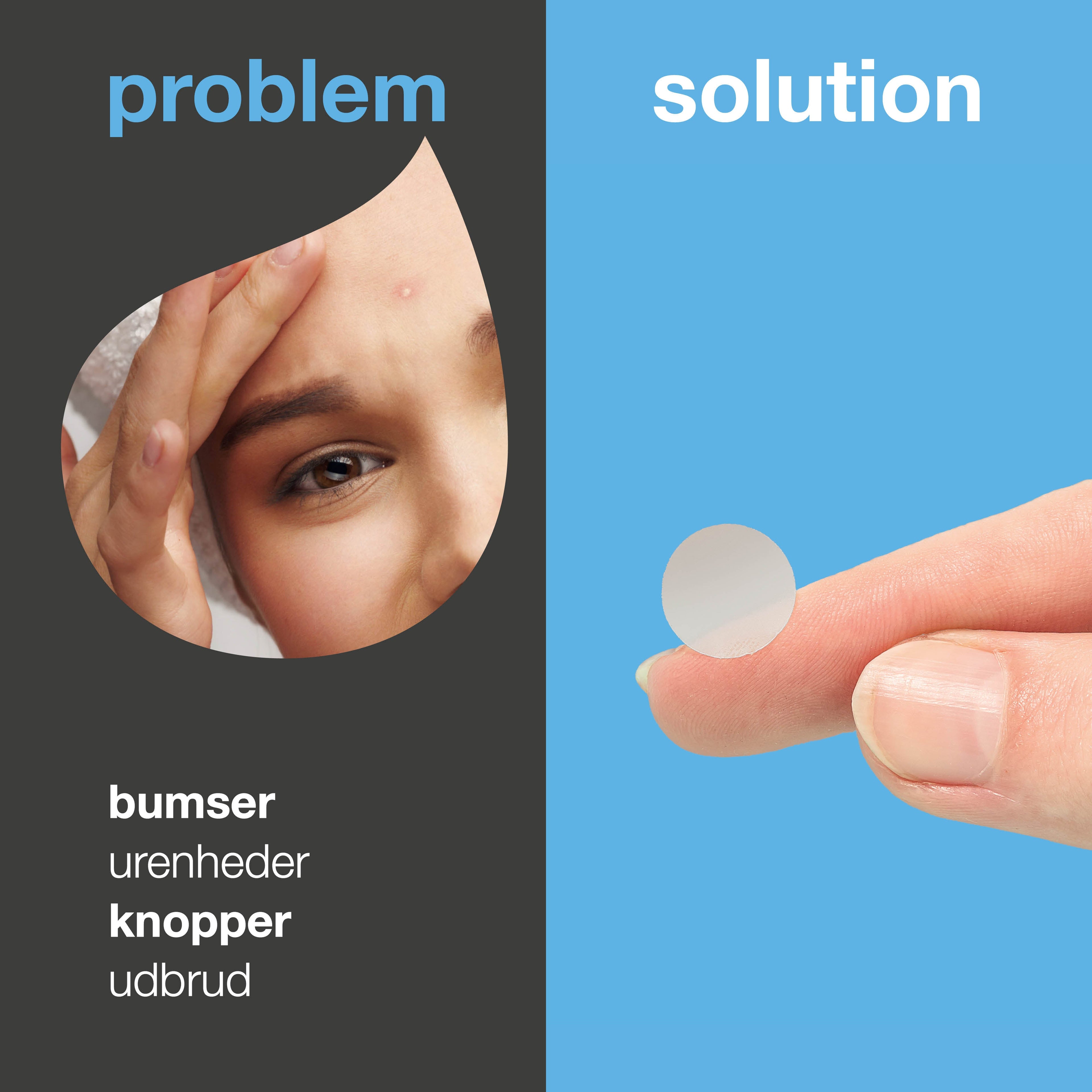 Salicylsyre Pimple Patches