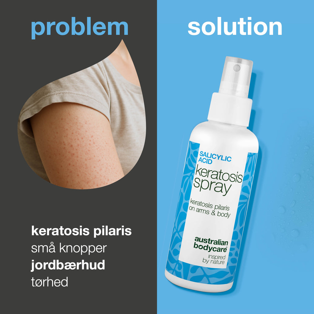 Keratosis Pilaris Spray