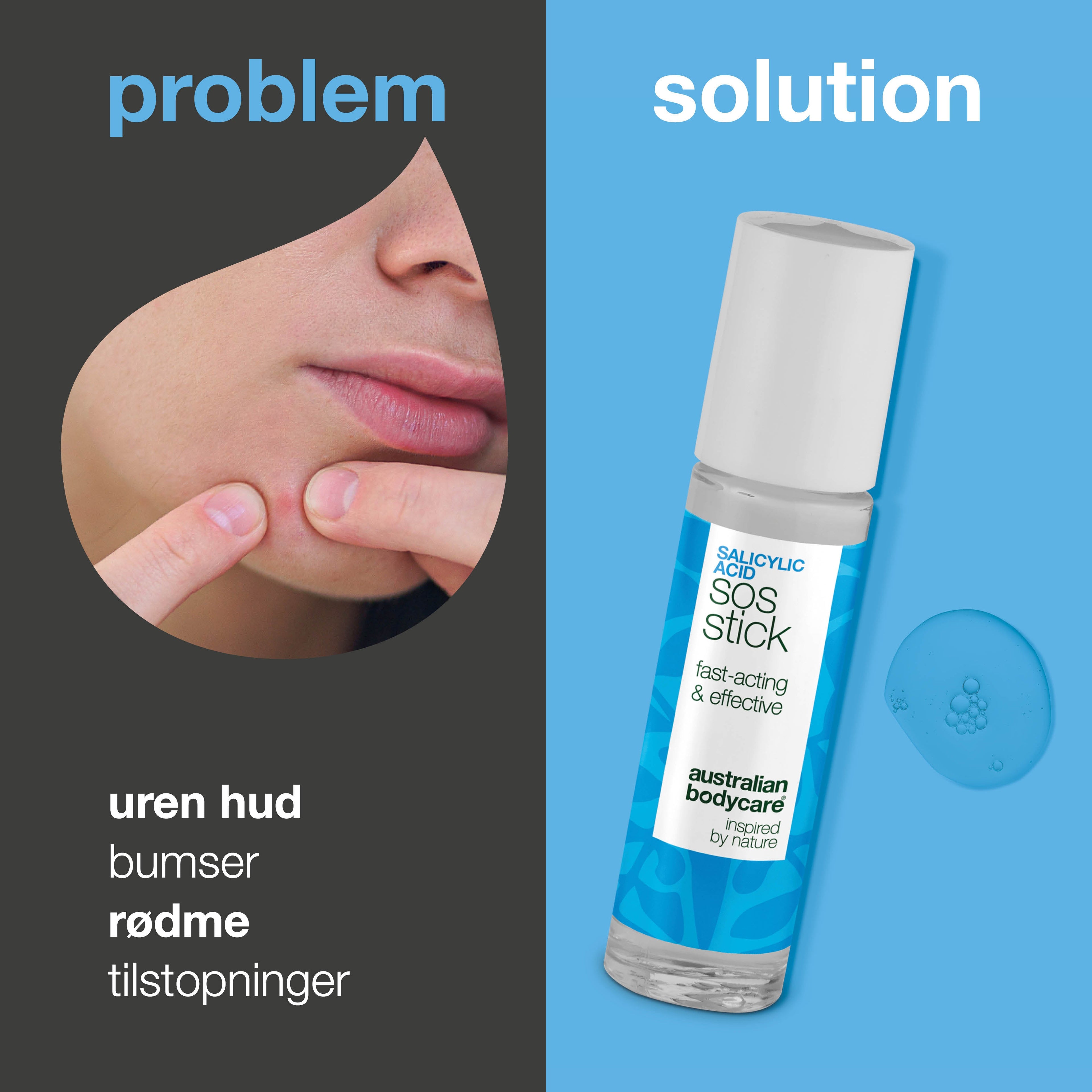 Salicylsyre SOS Stick