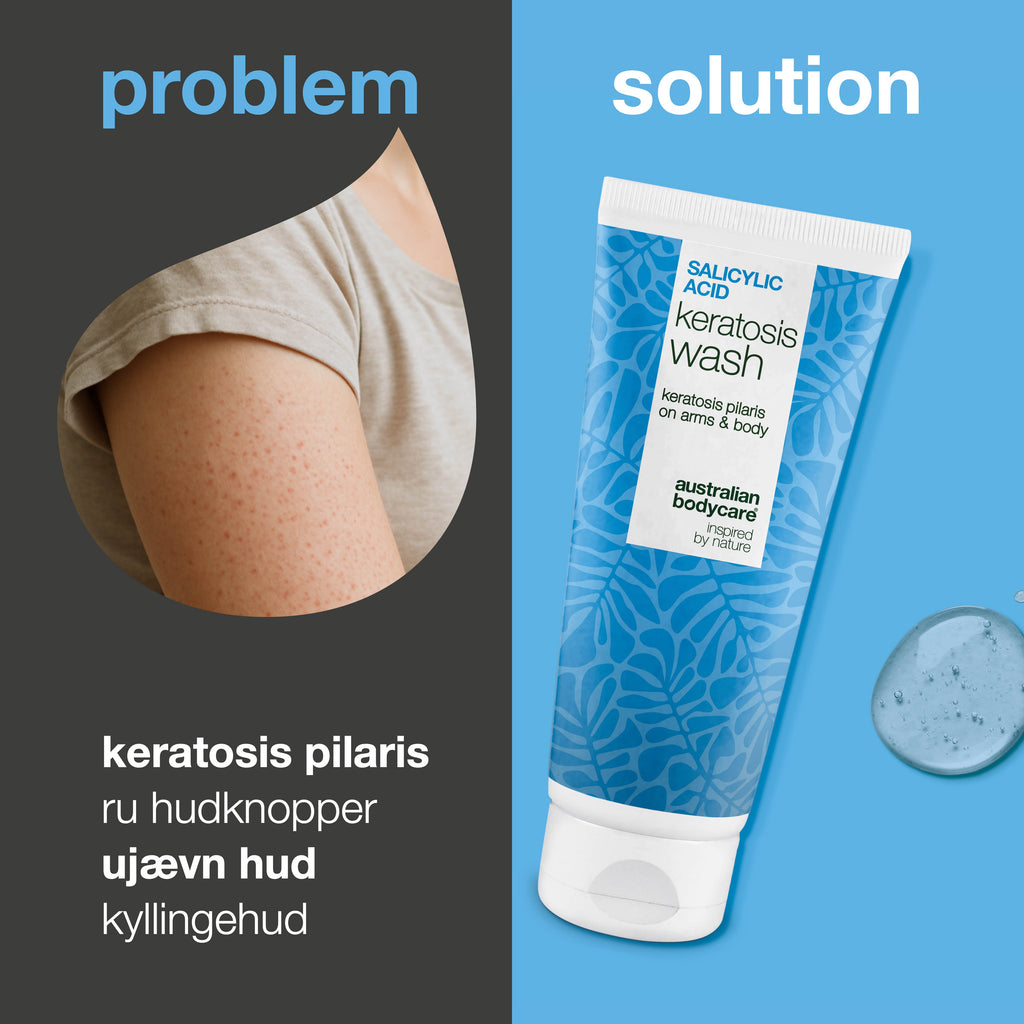 Keratosis Pilaris Body Wash – mod ru hud og små knopper — Keratosis Pilaris Body Wash mod ru hud og knopper fra keratosis pilaris. Med salicylsyre, niacinamid og glycerin for glattere hud.