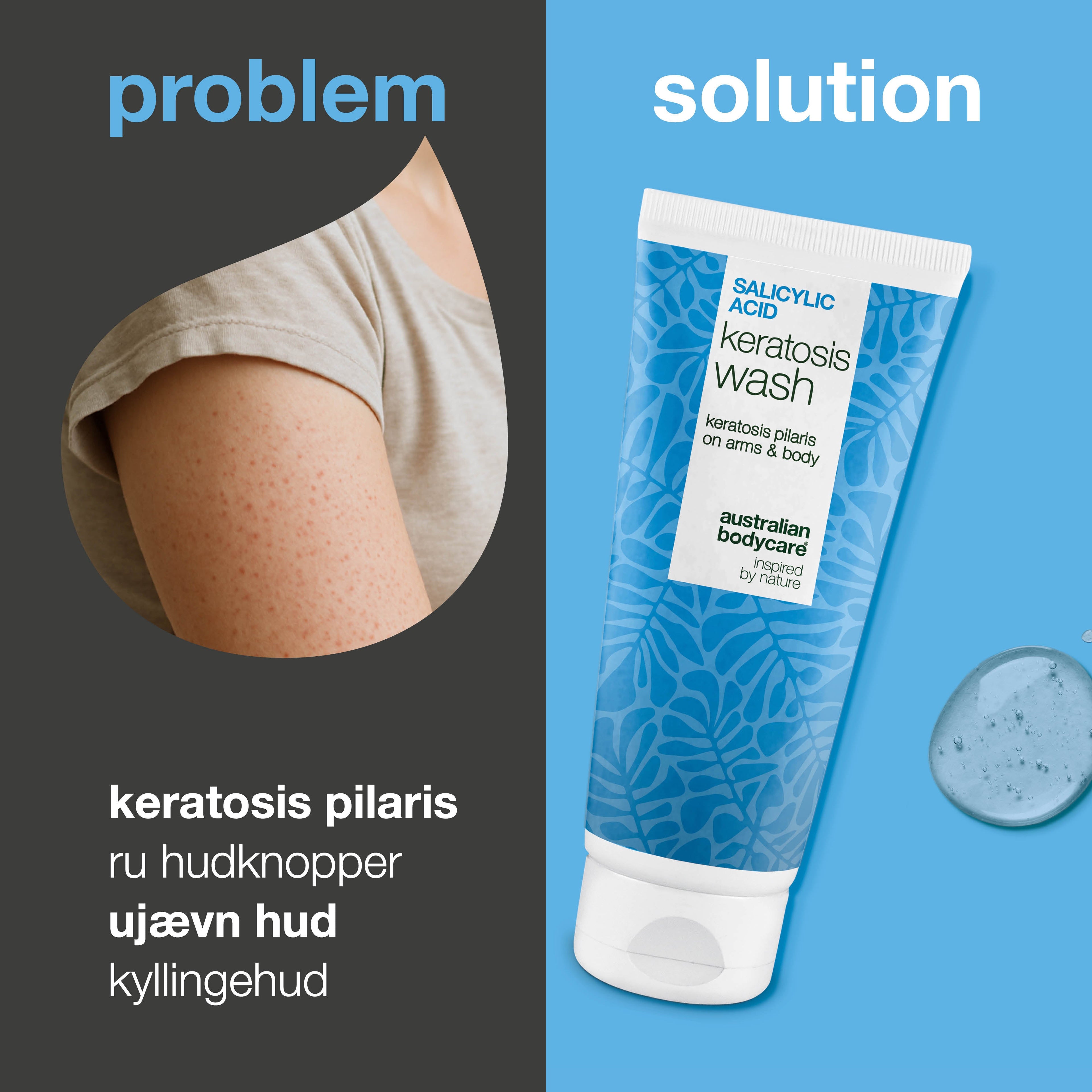 Keratosis Pilaris Body Wash – mod ru hud og små knopper — Keratosis Pilaris Body Wash mod ru hud og knopper fra keratosis pilaris. Med salicylsyre, niacinamid og glycerin for glattere hud.