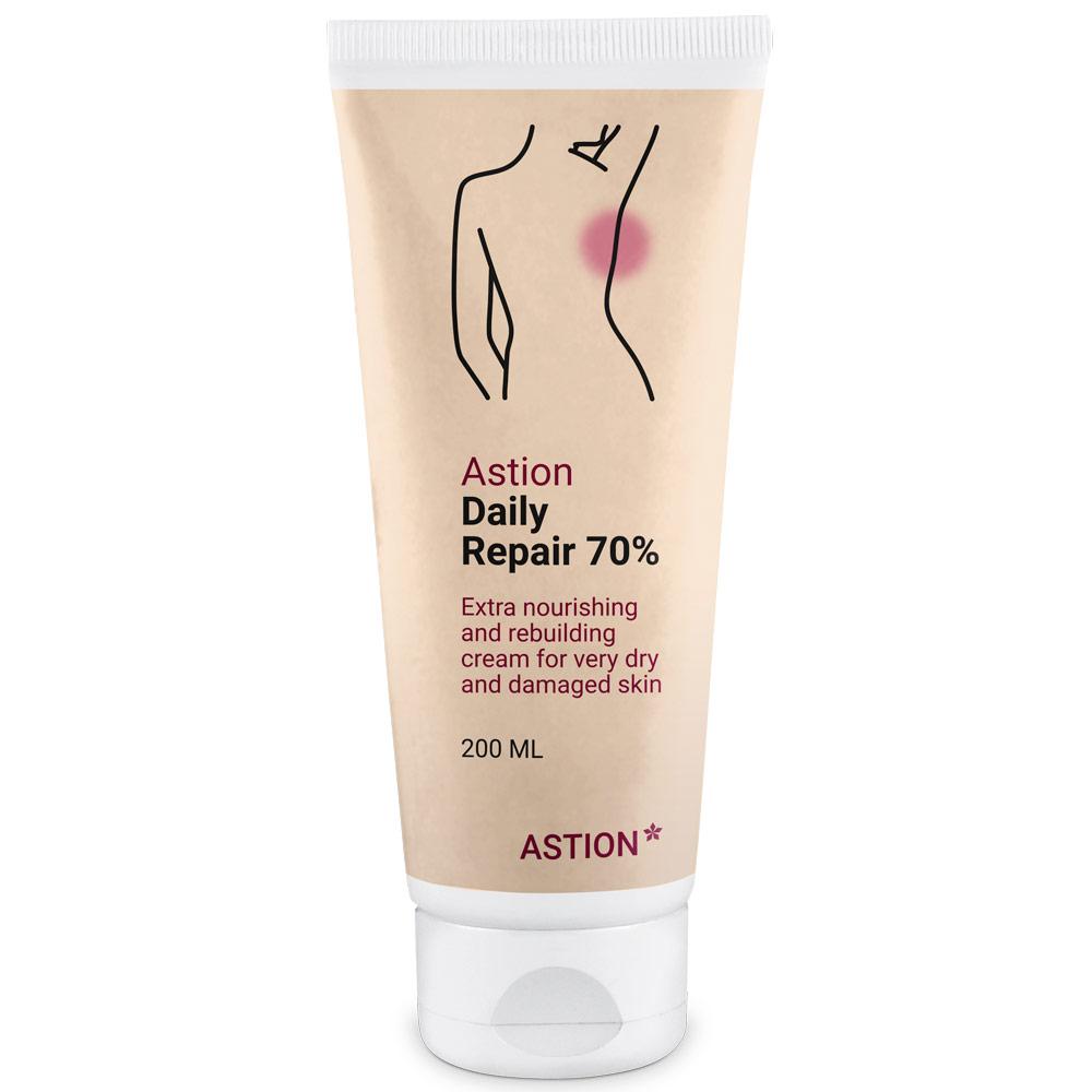 Astion Fat Cream 70% — Daily moisturizing care for eczema and itching